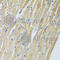 ADAM Metallopeptidase Domain 12 antibody, A7940, ABclonal Technology, Immunohistochemistry paraffin image 
