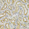 Four And A Half LIM Domains 1 antibody, 19-678, ProSci, Immunohistochemistry frozen image 