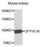 Zinc Finger FYVE-Type Containing 16 antibody, A06801, Boster Biological Technology, Western Blot image 