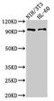 Interleukin 17 Receptor A antibody, orb51202, Biorbyt, Western Blot image 