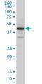 Zinc Finger Protein 124 antibody, H00007678-M01, Novus Biologicals, Western Blot image 