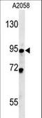 Sphingomyelin Phosphodiesterase 4 antibody, LS-C161321, Lifespan Biosciences, Western Blot image 