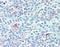 Ribosomal Protein S6 Kinase A2 antibody, ADI-KAS-ST007-E, Enzo Life Sciences, Immunohistochemistry paraffin image 