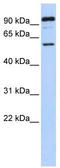 Gamma-Aminobutyric Acid Type A Receptor Rho1 Subunit antibody, TA338521, Origene, Western Blot image 