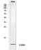 S100 Calcium Binding Protein A1 antibody, STJ97685, St John