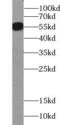 Solute carrier family 2, facilitated glucose transporter member 4 antibody, FNab03503, FineTest, Western Blot image 