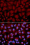 Butyrylcholinesterase antibody, STJ22770, St John