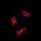 Adenosine A2b Receptor antibody, orb234999, Biorbyt, Immunocytochemistry image 