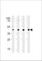 Steroid 5 Alpha-Reductase 3 antibody, A08082, Boster Biological Technology, Western Blot image 