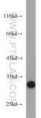 Cyclin Dependent Kinase 2 antibody, 10122-1-AP, Proteintech Group, Western Blot image 