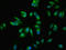 Galactose-1-Phosphate Uridylyltransferase antibody, LS-C317819, Lifespan Biosciences, Immunofluorescence image 