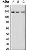 Inositol Polyphosphate Phosphatase Like 1 antibody, LS-C356130, Lifespan Biosciences, Western Blot image 