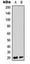 Trafficking Protein Particle Complex 3 antibody, orb315735, Biorbyt, Western Blot image 