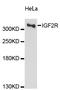Insulin Like Growth Factor 2 Receptor antibody, A13022, ABclonal Technology, Western Blot image 