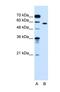 Oxysterol Binding Protein Like 9 antibody, NBP1-55152, Novus Biologicals, Western Blot image 