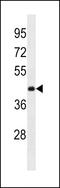 Ankyrin Repeat Domain 63 antibody, 60-335, ProSci, Western Blot image 