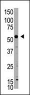 X-Linked Inhibitor Of Apoptosis antibody, PA5-13116, Invitrogen Antibodies, Western Blot image 