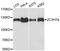 Zinc Finger CCCH-Type Containing 7A antibody, A15075, Boster Biological Technology, Western Blot image 