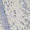Eukaryotic Translation Initiation Factor 3 Subunit C antibody, orb247746, Biorbyt, Immunohistochemistry paraffin image 