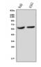 Interleukin 3 Receptor Subunit Alpha antibody, A04307, Boster Biological Technology, Western Blot image 