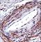 Purinergic Receptor P2X 5 antibody, LS-C163315, Lifespan Biosciences, Immunohistochemistry paraffin image 