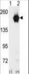 Cyclin G Associated Kinase antibody, LS-C101155, Lifespan Biosciences, Western Blot image 