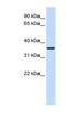 Fructose-Bisphosphatase 2 antibody, NBP1-56453, Novus Biologicals, Western Blot image 