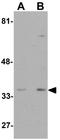 WD Repeat Domain 92 antibody, GTX85162, GeneTex, Western Blot image 
