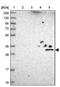 UTP23 Small Subunit Processome Component antibody, NBP1-92568, Novus Biologicals, Western Blot image 