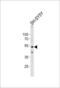 Dynactin Subunit 2 antibody, LS-C167306, Lifespan Biosciences, Western Blot image 