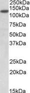 Sirtuin 1 antibody, LS-B8356, Lifespan Biosciences, Western Blot image 