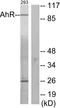 Aryl Hydrocarbon Receptor antibody, LS-B4900, Lifespan Biosciences, Western Blot image 