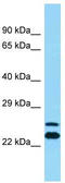 ADP Ribosylation Factor Interacting Protein 2 antibody, TA334956, Origene, Western Blot image 