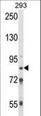 Threonyl-TRNA Synthetase Like 2 antibody, LS-B9153, Lifespan Biosciences, Western Blot image 