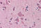 Necdin, MAGE Family Member antibody, MBS245716, MyBioSource, Immunohistochemistry frozen image 