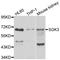 Serum/Glucocorticoid Regulated Kinase Family Member 3 antibody, A7586, ABclonal Technology, Western Blot image 