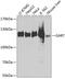 Phosphoribosylglycinamide Formyltransferase, Phosphoribosylglycinamide Synthetase, Phosphoribosylaminoimidazole Synthetase antibody, GTX64700, GeneTex, Western Blot image 