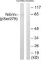 Nibrin antibody, PA5-38892, Invitrogen Antibodies, Western Blot image 