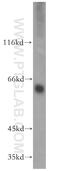 Monoamine Oxidase A antibody, 10539-1-AP, Proteintech Group, Western Blot image 