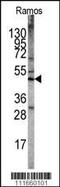 Serine/Threonine Kinase 11 antibody, MBS9211290, MyBioSource, Western Blot image 