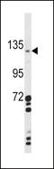 C-Type Lectin Domain Containing 16A antibody, LS-C168831, Lifespan Biosciences, Western Blot image 