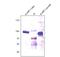 Fms Related Tyrosine Kinase 1 antibody, NB600-1007, Novus Biologicals, Western Blot image 