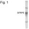 Secreted frizzled-related protein 5 antibody, PA1-4138, Invitrogen Antibodies, Western Blot image 