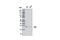 Carbonic Anhydrase 2 antibody, 8612S, Cell Signaling Technology, Western Blot image 