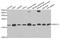 Ubiquitin Conjugating Enzyme E2 V1 antibody, LS-B13894, Lifespan Biosciences, Western Blot image 
