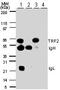 Telomeric Repeat Binding Factor 2 antibody, PA1-41023, Invitrogen Antibodies, Western Blot image 