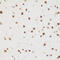 Rhabdomyosarcoma antigen MU-RMS-40.8 antibody, 22-728, ProSci, Immunohistochemistry paraffin image 