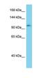 ELKS/RAB6-Interacting/CAST Family Member 2 antibody, orb326540, Biorbyt, Western Blot image 