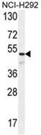 Angiopoietin 1 antibody, AP50175PU-N, Origene, Western Blot image 