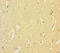 Cytochrome B-245 Beta Chain antibody, A50169-100, Epigentek, Immunohistochemistry paraffin image 